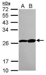 Anti-Proteasome 20S beta 3 antibody [N1C3] used in Western Blot (WB). GTX109566