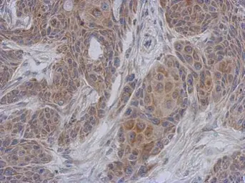 Anti-NDUFA12 antibody [N1C3] used in IHC (Paraffin sections) (IHC-P). GTX109567