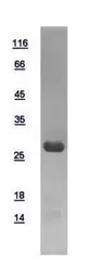 Human PGAM2 protein, His tag. GTX109582-pro