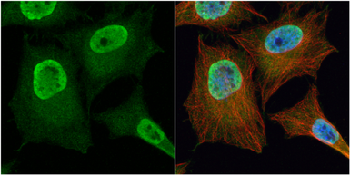 Anti-PGAM2 antibody used in Immunocytochemistry/ Immunofluorescence (ICC/IF). GTX109582