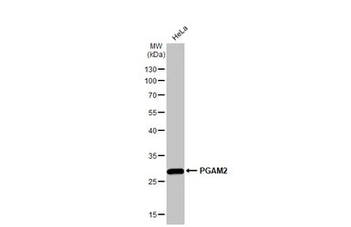 Anti-PGAM2 antibody used in Western Blot (WB). GTX109582