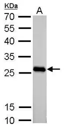 Anti-PGAM2 antibody used in Western Blot (WB). GTX109582