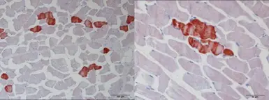 Anti-Troponin T1 (slow) skeletal muscle antibody used in IHC (Paraffin sections) (IHC-P). GTX109585