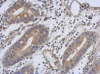 Anti-Troponin T1 (slow) skeletal muscle antibody used in IHC (Paraffin sections) (IHC-P). GTX109585