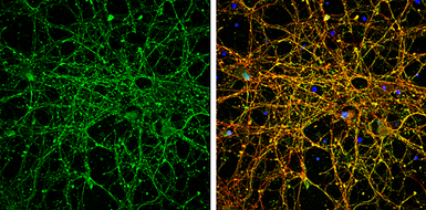 Anti-EEA1 antibody [C3], C-term used in Immunocytochemistry/ Immunofluorescence (ICC/IF). GTX109638