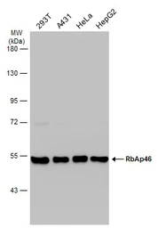 Anti-RbAp46 antibody [N1], N-term used in Western Blot (WB). GTX109640