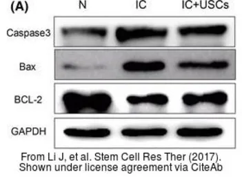 Anti-Bax antibody [N1N2], N-term used in Western Blot (WB). GTX109683