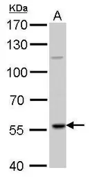 Anti-RAG2 antibody used in Western Blot (WB). GTX109710