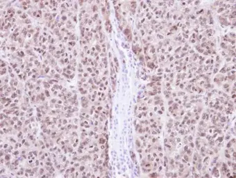 Anti-RAG2 antibody used in IHC (Paraffin sections) (IHC-P). GTX109710