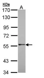 Anti-RAG2 antibody used in Western Blot (WB). GTX109710