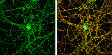 Anti-NMDAR2B antibody [C2C3], C-term used in Immunocytochemistry/ Immunofluorescence (ICC/IF). GTX109713