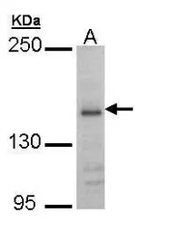 Anti-NMDAR2B antibody [C2C3], C-term used in Western Blot (WB). GTX109713