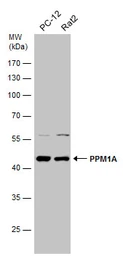 Anti-PPM1A antibody used in Western Blot (WB). GTX109744