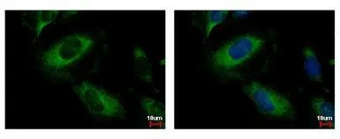 Anti-PPM1A antibody used in Immunocytochemistry/ Immunofluorescence (ICC/IF). GTX109744