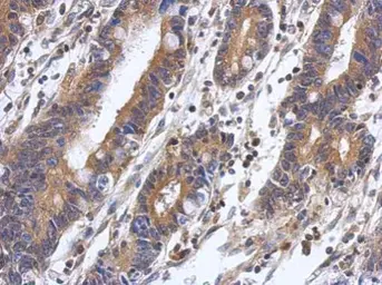 Anti-PPM1A antibody used in IHC (Paraffin sections) (IHC-P). GTX109744