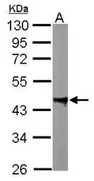 Anti-PPM1A antibody used in Western Blot (WB). GTX109744