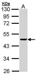 Anti-PPM1A antibody used in Western Blot (WB). GTX109744