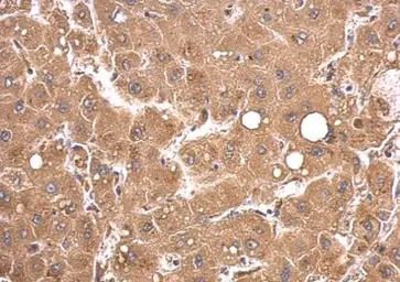 Anti-PEX5 antibody used in IHC (Paraffin sections) (IHC-P). GTX109798