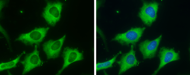 Anti-Fatty Acid Synthase antibody [N1], N-term used in Immunocytochemistry/ Immunofluorescence (ICC/IF). GTX109833