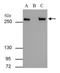 Anti-Fatty Acid Synthase antibody [N1], N-term used in Immunoprecipitation (IP). GTX109833