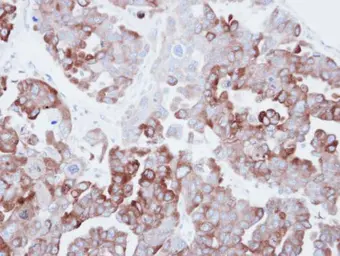 Anti-Fatty Acid Synthase antibody [N1], N-term used in IHC (Paraffin sections) (IHC-P). GTX109833