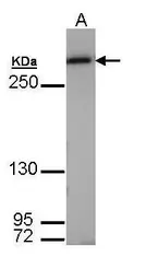 Anti-Fatty Acid Synthase antibody [N1], N-term used in Western Blot (WB). GTX109833