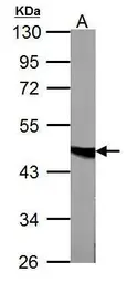 Anti-Fumarate hydratase antibody used in Western Blot (WB). GTX109877