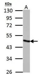 Anti-Fumarate hydratase antibody used in Western Blot (WB). GTX109877