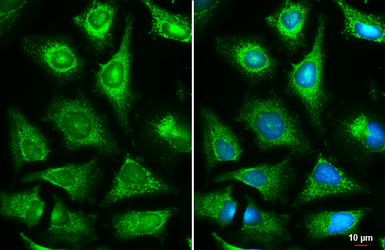 Anti-Fumarate hydratase antibody used in Immunocytochemistry/ Immunofluorescence (ICC/IF). GTX109877