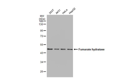 Anti-Fumarate hydratase antibody used in Western Blot (WB). GTX109877