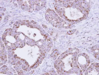 Anti-Fumarate hydratase antibody used in IHC (Paraffin sections) (IHC-P). GTX109877