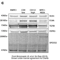 Anti-Filamin A antibody [N2], N-term used in Western Blot (WB). GTX109931