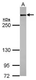 Anti-Filamin A antibody [N2], N-term used in Western Blot (WB). GTX109931