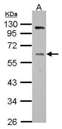 Anti-Vitamin D Binding Protein antibody used in Western Blot (WB). GTX109955