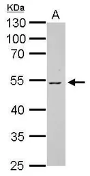 Anti-Vitamin D Binding Protein antibody used in Western Blot (WB). GTX109955