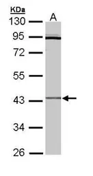 Anti-CRLF1 antibody [N2C3] used in Western Blot (WB). GTX109958