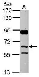 Anti-CFHR5 antibody used in Western Blot (WB). GTX109982