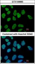 Anti-SALL4 antibody [C1C2], Internal used in Immunocytochemistry/ Immunofluorescence (ICC/IF). GTX109983