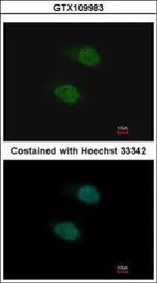 Anti-SALL4 antibody [C1C2], Internal used in Immunocytochemistry/ Immunofluorescence (ICC/IF). GTX109983