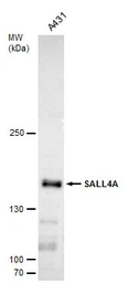 Anti-SALL4 antibody [C1C2], Internal used in Western Blot (WB). GTX109983