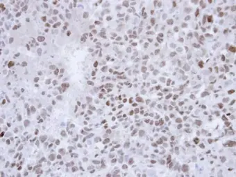 Anti-SALL4 antibody [C1C2], Internal used in IHC (Paraffin sections) (IHC-P). GTX109983