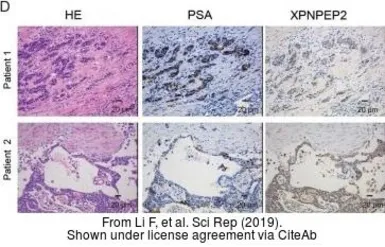 Anti-XPNPEP2 antibody [N3C3] used in IHC (Paraffin sections) (IHC-P). GTX109995