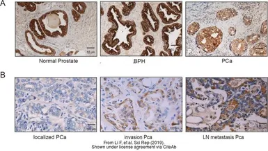 Anti-XPNPEP2 antibody [N3C3] used in IHC (Paraffin sections) (IHC-P). GTX109995