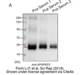 Anti-XPNPEP2 antibody [N3C3] used in Western Blot (WB). GTX109995