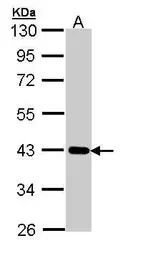 Anti-CRTAP antibody [N2C3-2] used in Western Blot (WB). GTX110055