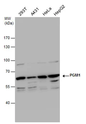 Anti-PGM1 antibody used in Western Blot (WB). GTX110069