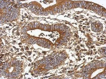 Anti-Vitamin D Binding Protein antibody used in IHC (Paraffin sections) (IHC-P). GTX110073