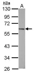 Anti-Vitamin D Binding Protein antibody used in Western Blot (WB). GTX110073