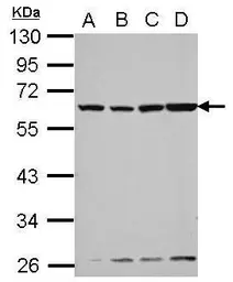 Anti-Vitamin D Binding Protein antibody used in Western Blot (WB). GTX110073