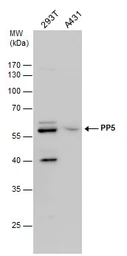 Anti-PPP5C antibody used in Western Blot (WB). GTX110090